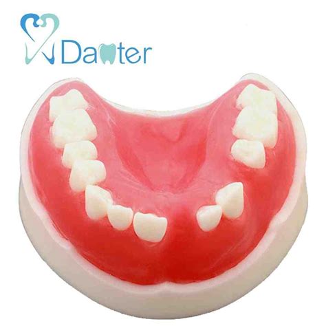 how much do dental implant sales reps make